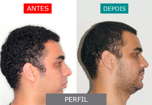 Caso 2 - Perfil