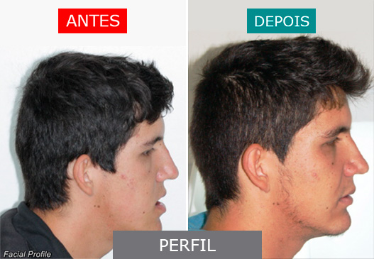 caso 7 - perfil