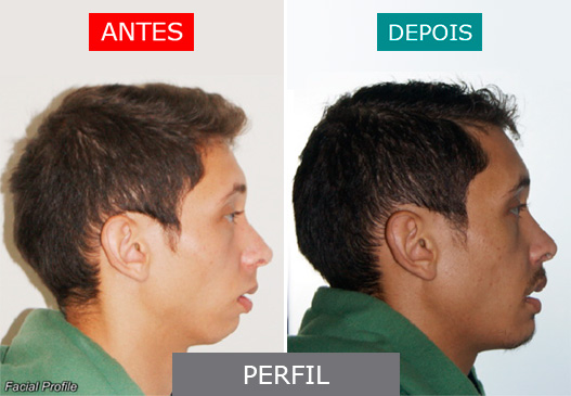 caso 10 - perfil