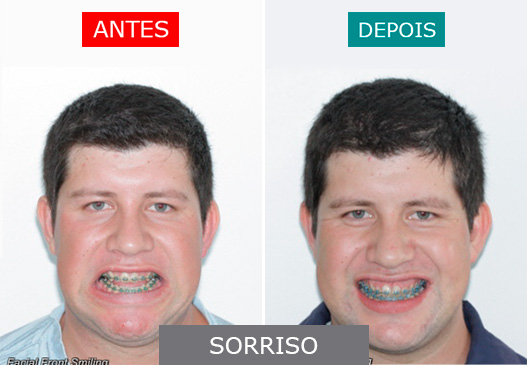 caso 8 - sorriso