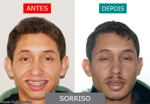 caso 10 - sorriso