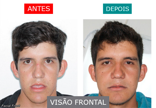 caso 7 - visão frontal