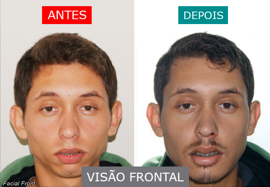 caso 10 - visão frontal